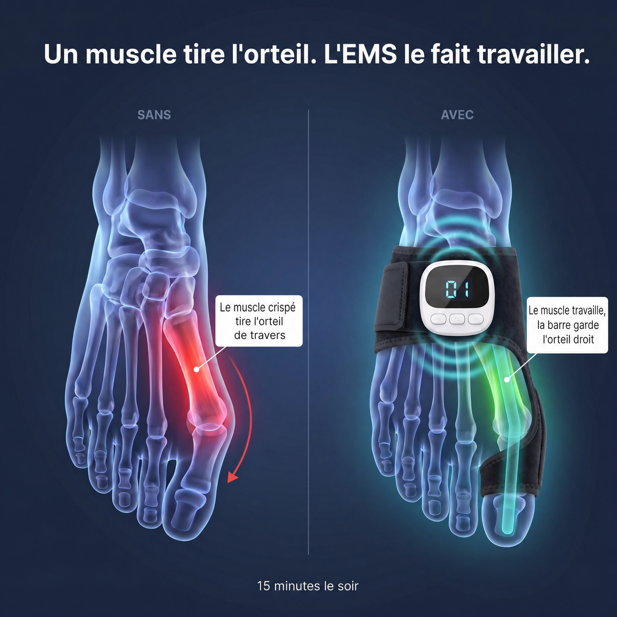 Un muscle tire l'orteil, l'EMS le fait travailler