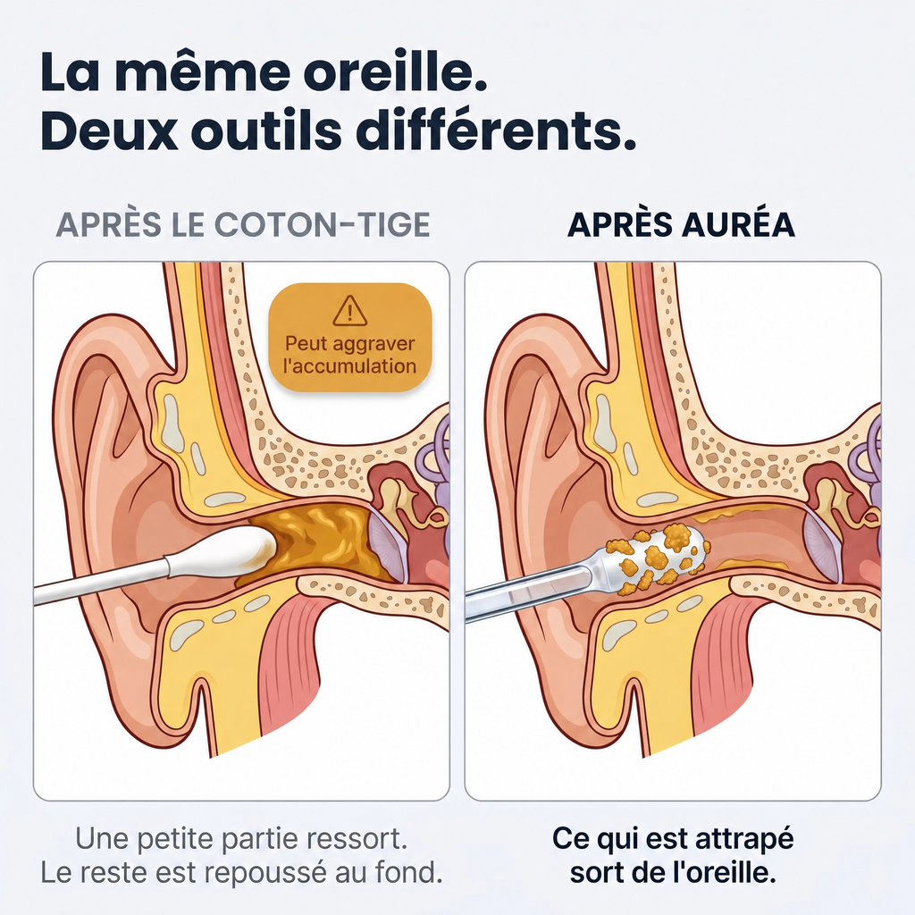 Auréa™ nettoyeur d'oreille adhésif