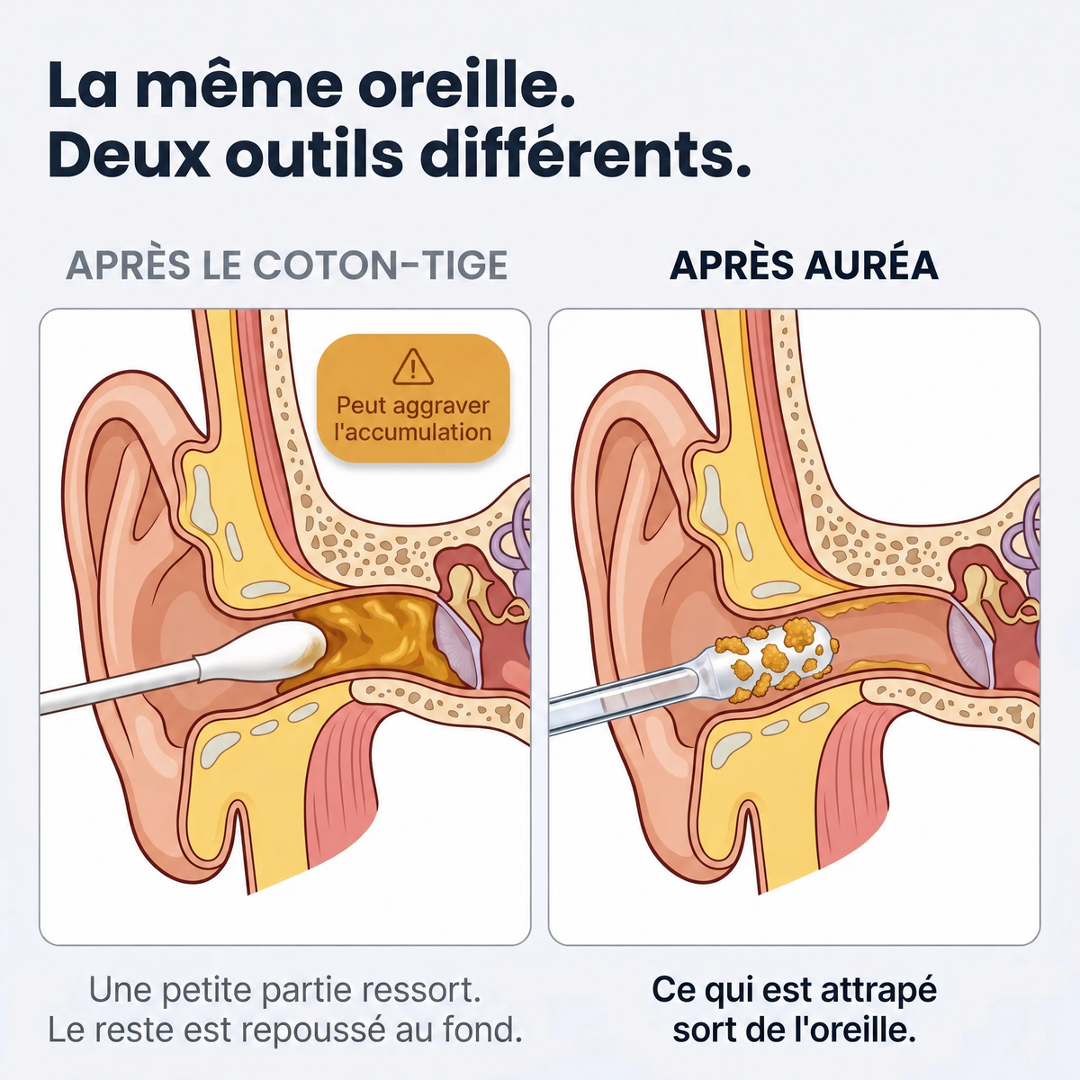 Auréa™ nettoyeur d'oreille adhésif